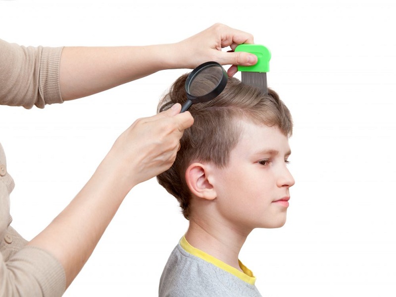 Causes of Hair Loss in Children