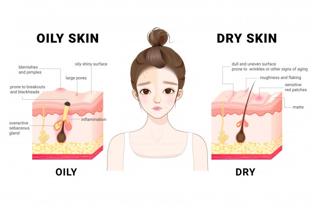 oily dry skin different human skin types conditions diagrammatic sectional view skin 137876 131