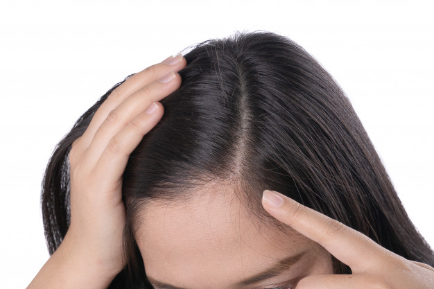 young asian women worry about problem hair loss head bald dandruff 9382 92